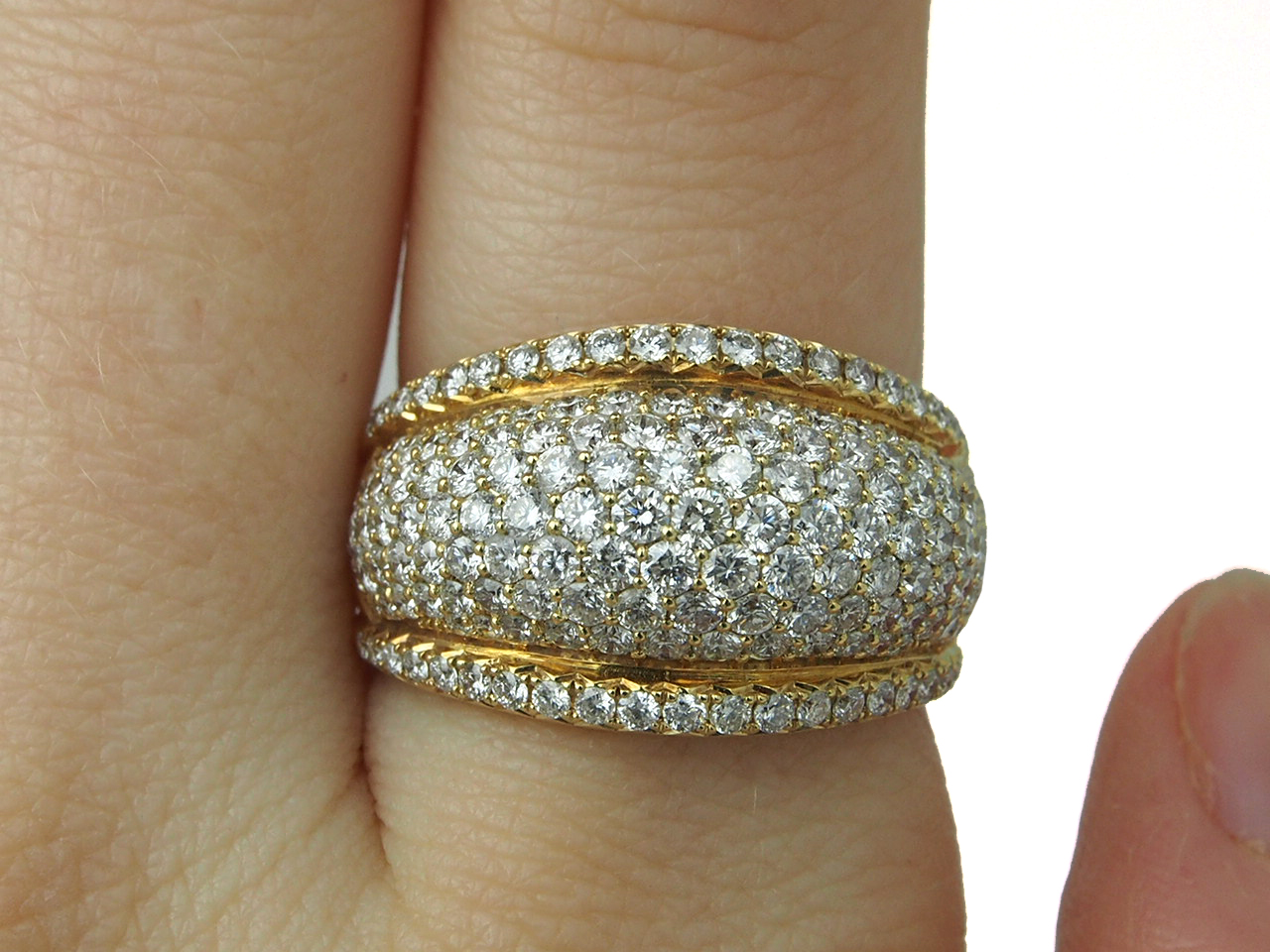 Diamond Bombe' Ring